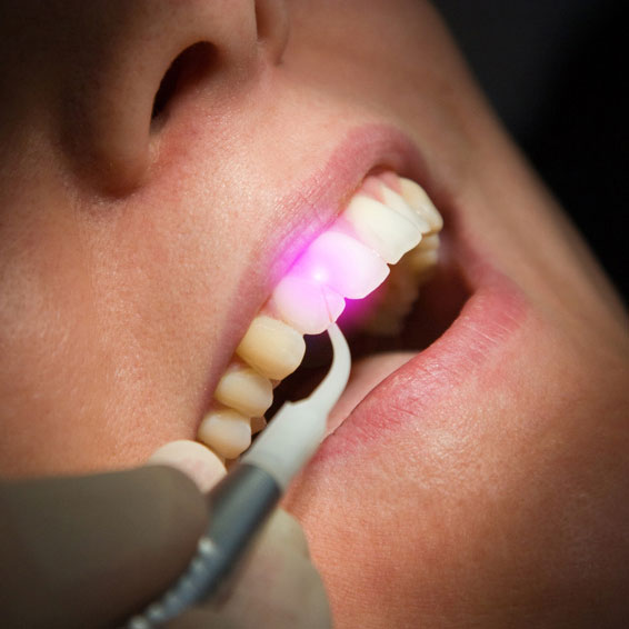  Schonender Eingriff mit dentaler Lasertechnik